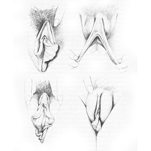 龙在天涯网(overseastudent.ca)：Image,贝蒂·道森（Betty Donson）在她的名书《自慰》（Sex For One）中使用过的插图，展现了女性器官的阴柔美丽