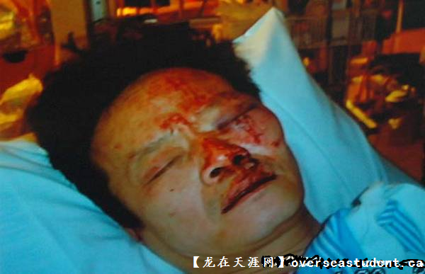华裔移民吴耀伟被警察殴打案件
